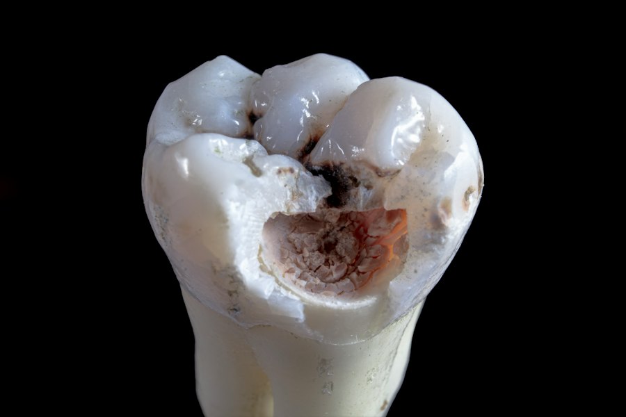 Photo tooth-root-anatomy-diagram