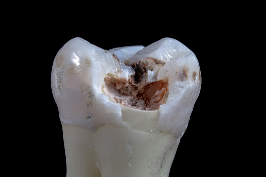 tooth-root-anatomy-diagram