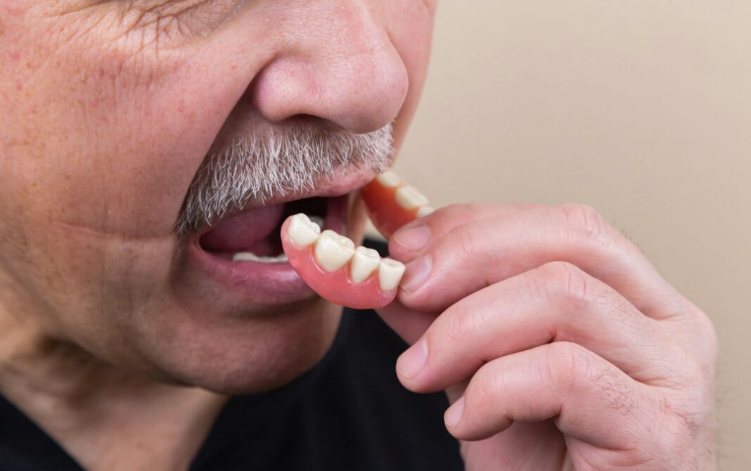 wpautoblog-image-40 Photo dental implants benefits differences